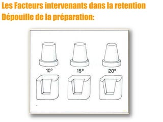 Les Facteurs intervenants dans la retention
Dépouille de la préparation:
 