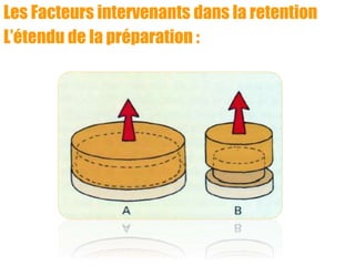 Les Facteurs intervenants dans la retention
L’étendu de la préparation :
 