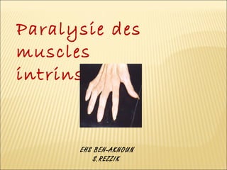 Paralysie des 
muscles 
intrinsèques 
EHS BEN-AKNOUN 
S.REZZIK 
 