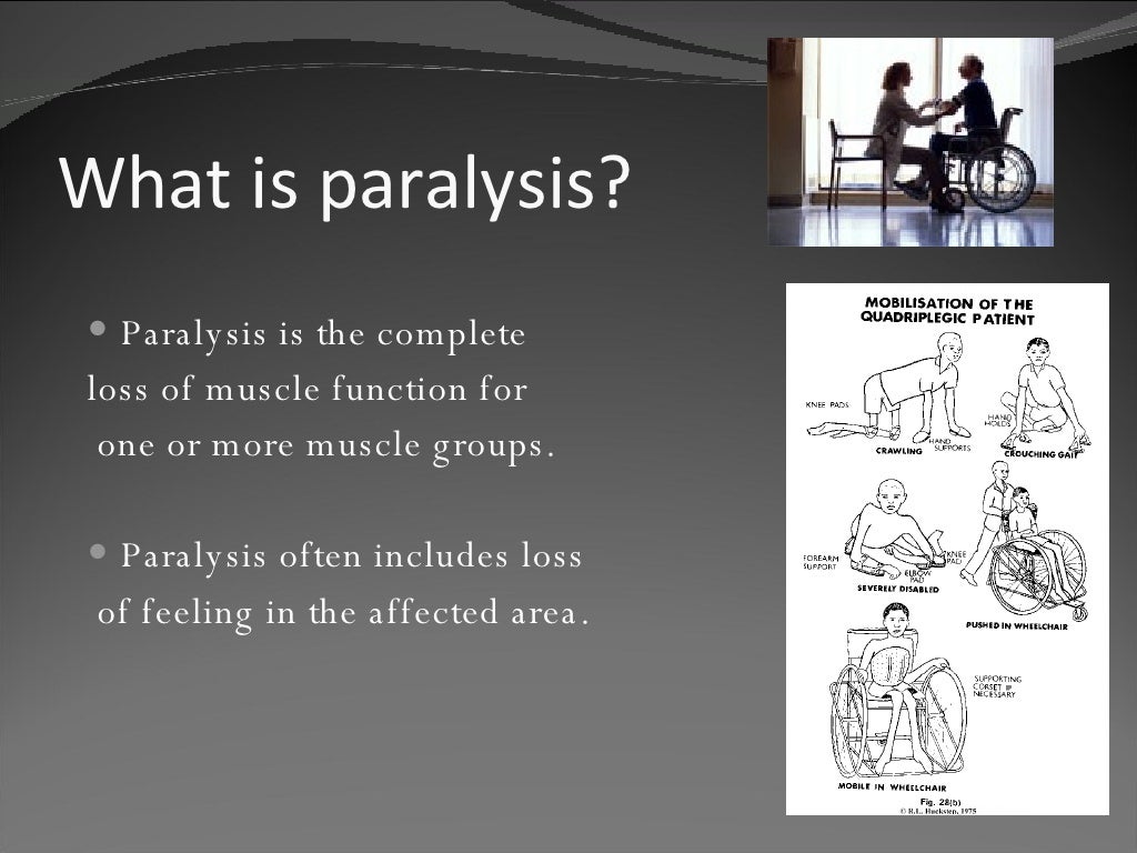 Paralysis