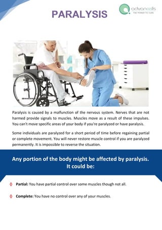 Paralysis is caused by a malfunction of the nervous system. Nerves that are not
harmed provide signals to muscles. Muscles move as a result of these impulses.
You can't move specific areas of your body if you're paralyzed or have paralysis.
Some individuals are paralyzed for a short period of time before regaining partial
or complete movement. You will never restore muscle control if you are paralyzed
permanently. It is impossible to reverse the situation.
 Partial: You have partial control over some muscles though not all.
 Complete: You have no control over any of your muscles.
Any portion of the body might be affected by paralysis.
It could be:
 