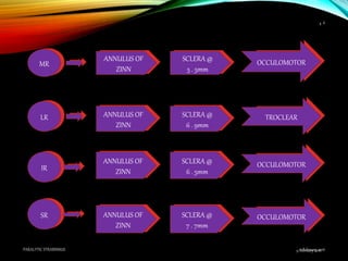 9 February 2016PARALYTIC STRABISMUS
4
9 February 2016
4
MR
LR
IR
SR
ANNULUS OF
ZINN
SCLERA @
5 . 5mm
OCCULOMOTOR
ANNULUS OF
ZINN
SCLERA @
6 . 9mm
TROCLEAR
ANNULUS OF
ZINN
SCLERA @
6 . 5mm
OCCULOMOTOR
ANNULUS OF
ZINN
SCLERA @
7 . 7mm
OCCULOMOTOR
 