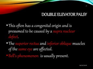 DOUBLE ELEVATOR PALSY
•This often has a congenital origin and is
presumed to be caused by a supra nuclear
defect.
•The superior rectus and inferior oblique muscles
of the same eye are affected.
•Bell’s phenomenon is usually present.
09/02/2016
48
 