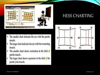 HESS CHARTING
9 February 2016PARALYTIC STRABISMUS
55
 