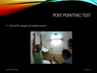 POST POINTING TEST
• A test of the integrity of vestibular system.
9 February 2016PARALYTIC STRABISMUS
57
 