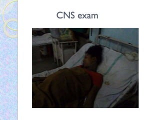 CNS exam
 