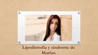 Lipodistrofia y síndrome de
Marfan
 