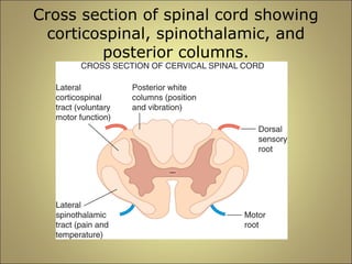 Cross section of spinal cord showing 
corticospinal, spinothalamic, and 
posterior columns. 
 