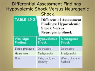 Differential Assessment Findings: 
Hypovolemic Shock Versus Neurogenic 
Shock 
 