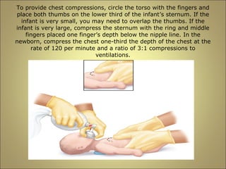 To provide chest compressions, circle the torso with the fingers and 
place both thumbs on the lower third of the infant’s sternum. If the 
infant is very small, you may need to overlap the thumbs. If the 
infant is very large, compress the sternum with the ring and middle 
fingers placed one finger’s depth below the nipple line. In the 
newborn, compress the chest one-third the depth of the chest at the 
rate of 120 per minute and a ratio of 3:1 compressions to 
ventilations. 
 