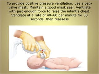 To provide positive pressure ventilation, use a bag-valve 
mask. Maintain a good mask seal. Ventilate 
with just enough force to raise the infant’s chest. 
Ventilate at a rate of 40–60 per minute for 30 
seconds, then reassess 
 