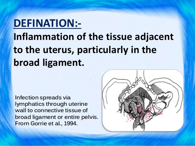Parametritis/ Pelvic Cellulitis