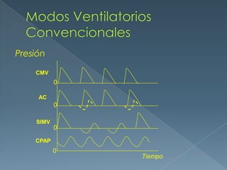 Presión
CMV
AC
SIMV
CPAP
Tiempo
0
0
0
0
 