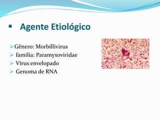  Agente Etiológico
Gênero: Morbillivirus
 família: Paramyxoviridae
 Vírus envelopado
 Genoma de RNA
 
