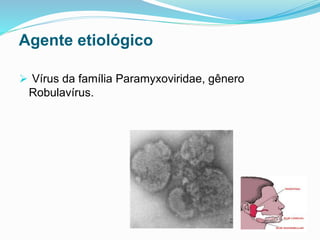Agente etiológico
 Vírus da família Paramyxoviridae, gênero
Robulavírus.
 
