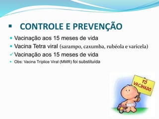  CONTROLE E PREVENÇÃO
 Vacinação aos 15 meses de vida
 Vacina Tetra viral (sarampo, caxumba, rubéola e varicela)
Vacinação aos 15 meses de vida
 Obs: Vacina Tríplice Viral (MMR) foi substituída
 