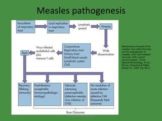 Measles pathogenesis Mechanisms of spread of the measles virus within the body and the pathogenesis of measles. CMI, Cell-mediated immunity; CNS, central nervous system.  (From Medical Microbiology, 5 th  ed., Murray, Rosenthal & Pfaller, Mosby Inc., 2005, Fig. 59-3.) www.freelivedoctor.com 