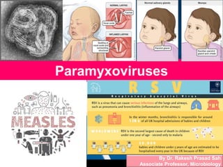 Paramyxoviruses
By Dr. Rakesh Prasad Sah
Associate Professor, Microbiology
 