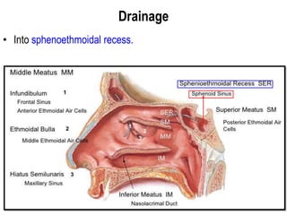 Drainage
• Into sphenoethmoidal recess.
 