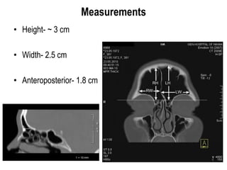 Measurements
• Height- ~ 3 cm
• Width- 2.5 cm
• Anteroposterior- 1.8 cm
 
