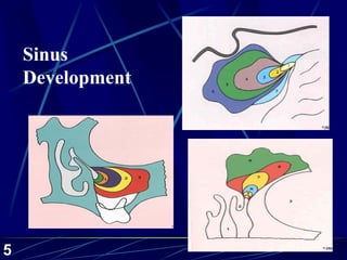 Frontal Sinus Development Paranasal sinus-2002-01-slides | PDF