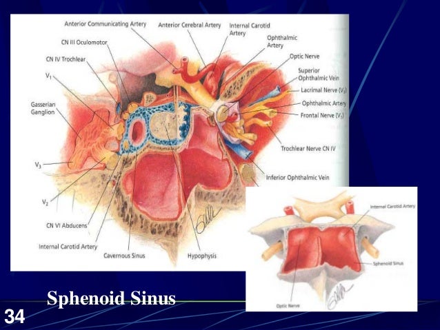 paranasal sinus200201slides 34 638