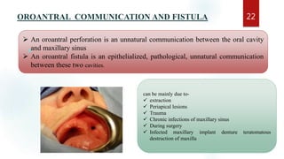OROANTRAL COMMUNICATION AND FISTULA 22
 An oroantral perforation is an unnatural communication between the oral cavity
and maxillary sinus
 An oroantral fistula is an epithelialized, pathological, unnatural communication
between these two cavities.
can be mainly due to-
 extraction
 Periapical lesions
 Trauma
 Chronic infections of maxillary sinus
 During surgery
 Infected maxillary implant denture teratomatous
destruction of maxilla

 