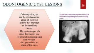 ODONTOGENIC CYST LESIONS 26
Odontogenic cysts
are the most common
group of extrinsic
lesions that encroach
on the maxillary
sinuses.
• The cyst enlarges ,the
sinus decrease in size
• The result is radioopaque
line between
the cyst and the air
space of the sinus.
 