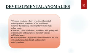 DEVELOPMENTALANOMALIES 31
• Crouzon syndrome : Early synostosis (fusion) of
sutures produces hypoplasia of the maxilla and
therefore the maxillary sinus together with the high
arched palate.
• Treacher Collins syndrome : Associated with grossly and
symmetrically underdeveloped maxillary sinuses
and Malar bones.
• Binder syndrome : Hypoplasia of middle third of the face
with smaller maxillary length and maxillary
sinus hypoplasia.
 