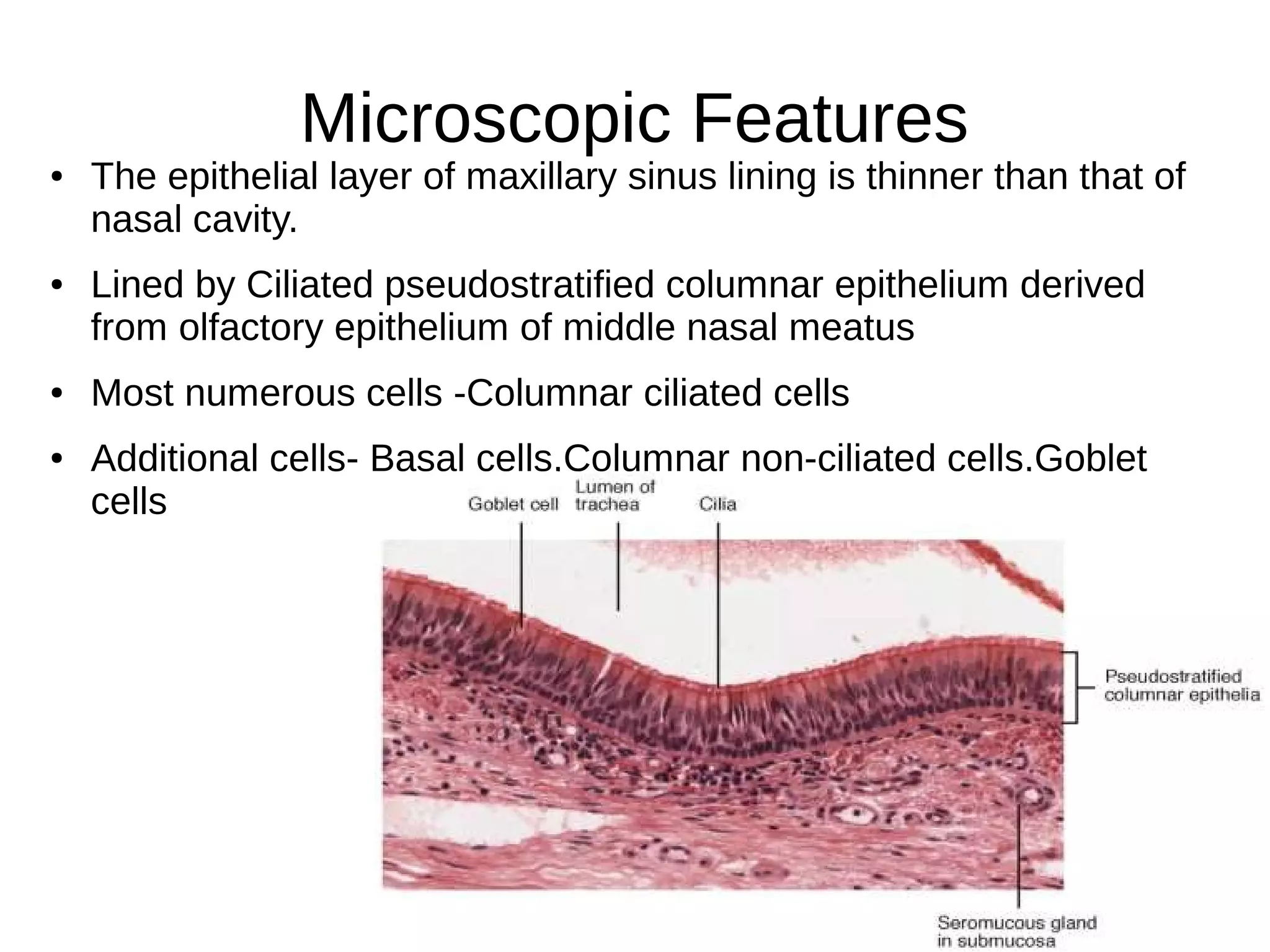 Paranasal sinuses | ODP