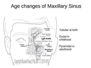 Age changes of Maxillary Sinus
Tubular at birth
Ovoid in
childhood
Pyramidal in
adulthood
 