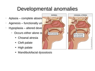 Developmental anomalies
• Aplasia – complete absence
• Agenesis – functionally underdevelopment
• Hypoplasia – altered development
➢ Occurs either alone or in association with other anamolies -
➔ Choanal atresia
➔ Cleft palate
➔ High palate
➔ Mandibulofacial dysostosis
 