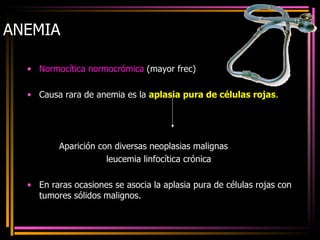 ANEMIA Normocítica normocrómica  (mayor frec) Causa rara de anemia es la  aplasia pura de células rojas . Aparición con diversas neoplasias malignas    leucemia linfocítica crónica En raras ocasiones se asocia la aplasia pura de células rojas con tumores sólidos malignos. 