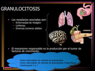 GRANULOCITOSIS Las neoplasias asociadas son: Enfermedad de Hodgkin Linfomas Diversos tumores sólidos El mecanismo responsable es la producción por el tumor de factores de crecimiento. Factor estimulador de colonias de granulocitos Factor estimulador de colonias de granulocitos y macrófagos Interleuquina 3 y 1 