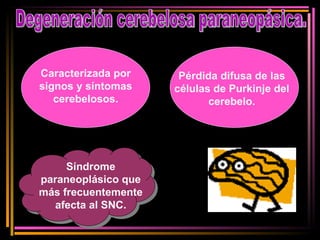 Degeneración cerebelosa paraneopásica. Caracterizada por signos y síntomas cerebelosos. Pérdida difusa de las células de Purkinje del cerebelo. Síndrome paraneoplásico que más frecuentemente afecta al SNC. 