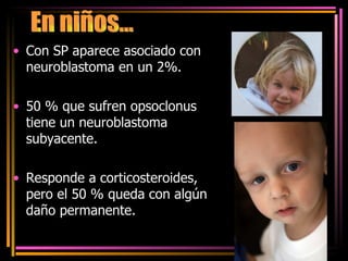 Con SP aparece asociado con neuroblastoma en un 2%. 50 % que sufren opsoclonus tiene un neuroblastoma subyacente. Responde a corticosteroides, pero el 50 % queda con algún daño permanente. En niños... 