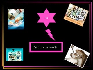 TX Del tumor responsable.  