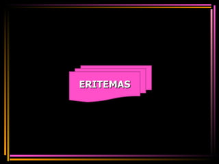 ERITEMAS 