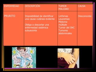 ENFERMEDAD DESCRIPCIÓN TUMOR MALIGNO CAUSA PRURITO Imposibilidad de identificar una causa cutánea evidente Obliga a descartar una enfermedad sistémica subyacente Linfomas Leucemias Mieloma múltiple Tumor del SNC Tumores abdominales  Desconocida 
