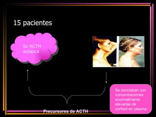 15 pacientes Sx ACTH ectópica Precursores de ACTH Se asociaban con concentraciones anormalmente elevadas de cortisol en plasma. 