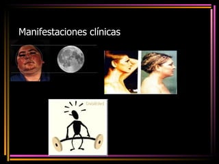 Manifestaciones clínicas 
