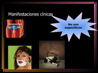 Manifestaciones cínicas Amenorrea No son específicos 