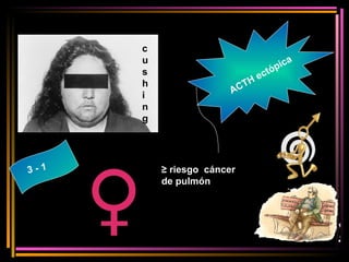 3 - 1 ACTH ectópica cushing ≥  riesgo  cáncer de pulmón 