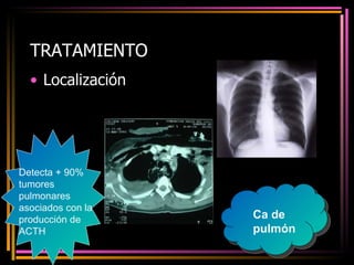 TRATAMIENTO Localización Ca de pulmón Detecta + 90% tumores pulmonares asociados con la producción de ACTH 