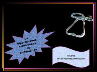 La hipocalcemia raras veces es sintomática  Tetania irritabilidad neuromuscular 
