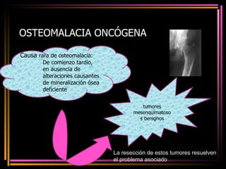 OSTEOMALACIA ONCÓGENA Causa  rara de osteomalacia: De comienzo tardío, en ausencia de alteraciones causantes de mineralización ósea deficiente tumores mesenquimatosos benignos La resección de estos tumores resuelven el problema asociado 