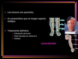 Los tumores son parecidos. Es característico que no tengan aspecto maligno. Tratamiento definitivo Extirpación del tumor  Dosis elevadas de vitamina D fosfatos LOCALIZACIÒN 