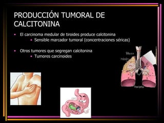 PRODUCCIÓN TUMORAL DE CALCITONINA El carcinoma medular de tiroides produce calcitonina Sensible marcador tumoral (concentraciones séricas) Otros tumores que segregan calcitonina Tumores carcinoides 