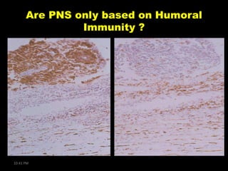 Are PNS only based on Humoral
Immunity ?

10:41 PM

 