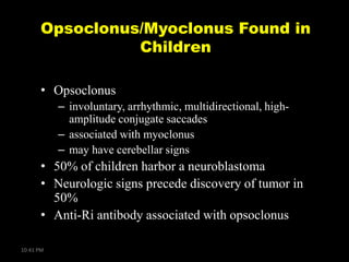 Opsoclonus/Myoclonus Found in
Children
• Opsoclonus
– involuntary, arrhythmic, multidirectional, highamplitude conjugate saccades
– associated with myoclonus
– may have cerebellar signs

• 50% of children harbor a neuroblastoma
• Neurologic signs precede discovery of tumor in
50%
• Anti-Ri antibody associated with opsoclonus
10:41 PM

 